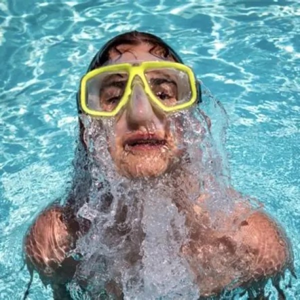 swimming pool accident lawyer